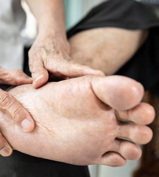 Can proper footwear prevent corns?