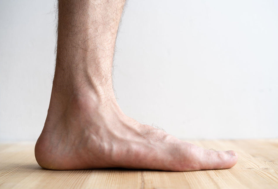 What is a fallen arch on your foot?