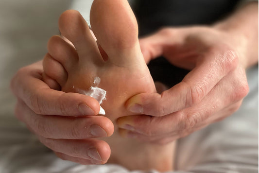 Why should you moisturise your feet?
