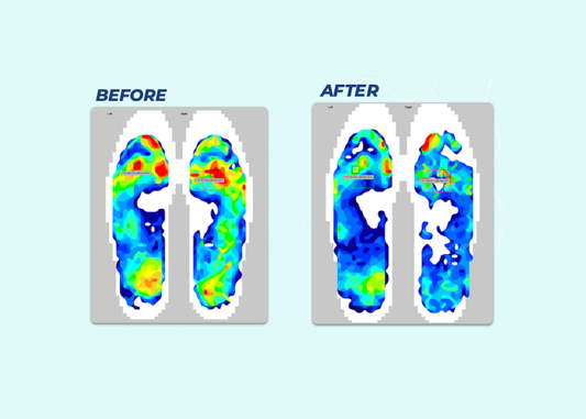 How Does ZeroSole Redistribute Pressure?
